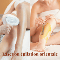 Laser ou Épilation orientale