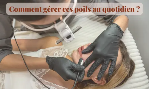 Poils du visage : comment gérer ces poils au quotidien ?
